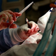 Illustration for article titled Angry Midwife Takes Horrifying Revenge On Patient's Anus
